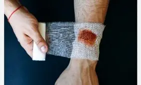 مراقبت اورژانسی مهم در شرایط جنگی