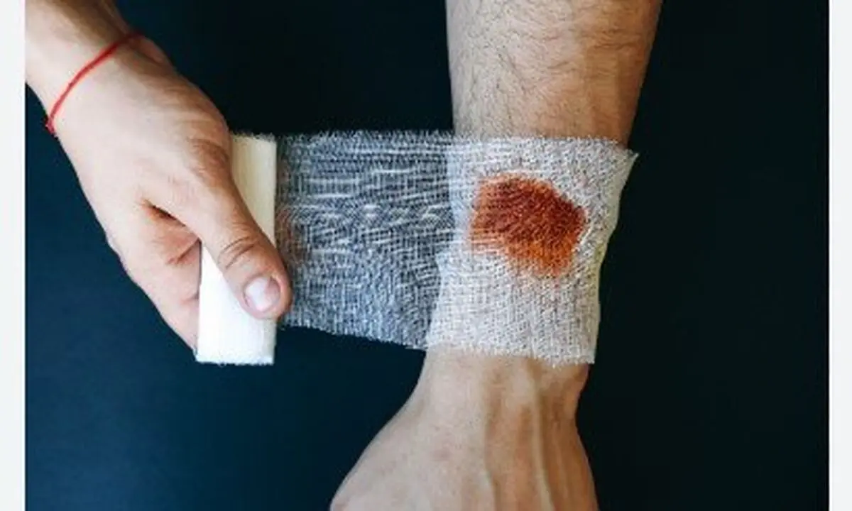 مراقبت اورژانسی مهم در شرایط جنگی