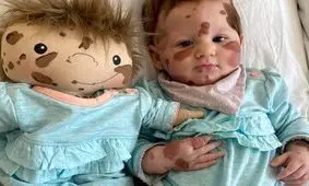 «عروسک‌های معلول» را می‌توان وارد دنیای کودکان کرد؟

