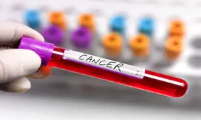 چرا برخی سرطان ها بعد از درمان عود می‌کنند؟