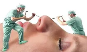 کاهش خیره‌کننده عمل زیبایی در ایران!