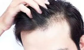 راهکارهای طب ایرانی برای تقویت مو