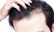 راهکارهای طب ایرانی برای تقویت مو