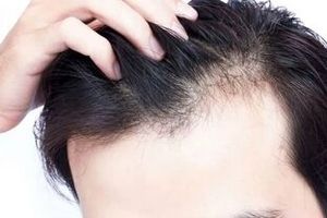 راهکارهای طب ایرانی برای تقویت مو