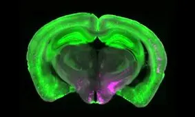 دانشمندان کلید خاموش کردن درد را کشف کردند

