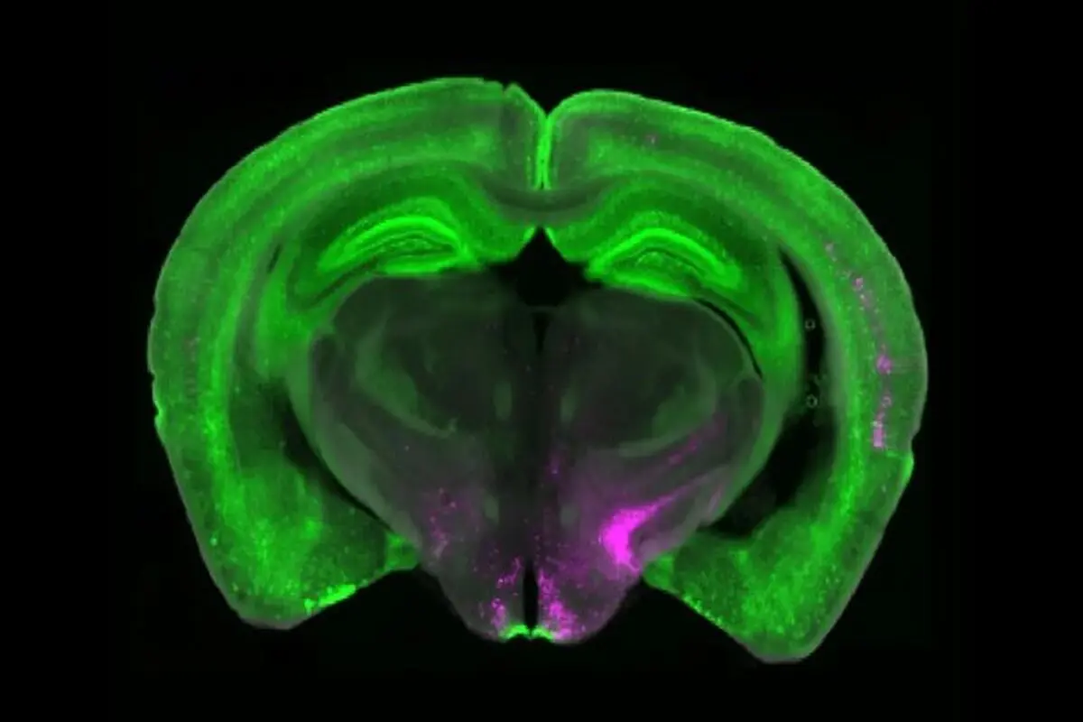 دانشمندان کلید خاموش کردن درد را کشف کردند

