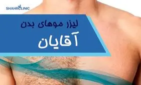 لیزر موهای زائد بدن راحت ترین و بی دردسرترین راه