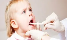 علائم «گلودرد استرپتوکوکی» در کودکان