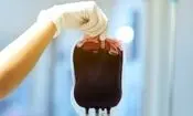 آیا آلزایمر با انتقال خون منتقل می‌شود؟