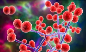 باورهای غلط درباره عفونت های زنان