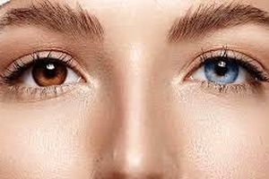تغییر رنگ چشم؛ یک جراحی زیبایی پرخطر