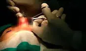 جراحی زیبایی به قیمت جان؛ مرگ دختر جوان در پی عمل بینی
