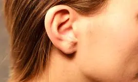 علت بوی بد پشت گوش چیست؟