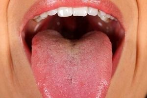 میکروبیوم دهان چیست؟