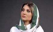 تصویر تازه از تغییر چهره گلوریا هاردی