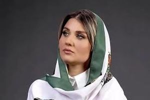 تصویر تازه از تغییر چهره گلوریا هاردی