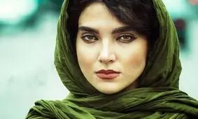 تغییر چهره سارا رسول زاده بعد از عمل