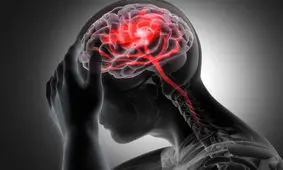 شیوع سکته مغزی در ایران بالاتر از کشورهای دیگر است/ کاهش سن مبتلایان/ بیمار حاد را فقط باید به بیمارستان‌های دولتی منتقل کنید