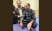 قطع شدن انگشتان مرد خوزستانی بر اثر انفجار مین