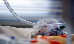 مرگ تلخ مرد تهرانی در زیر تیغ جراحی زیبایی