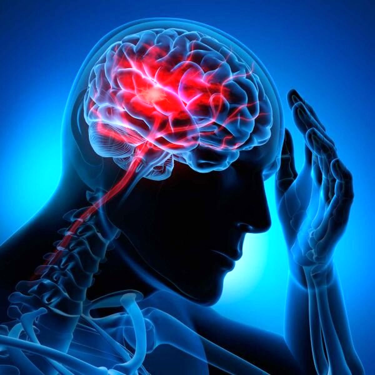 چگونه می‌توان از سکته مغزی جلوگیری کرد؟