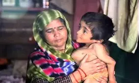 پسری که استخوان‌هایش با کوچک‌ترین لمس می‌شکند!/ ویدئو
