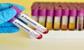 علائم تالاسمی چیست؟