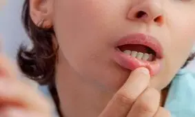 زخم های دردناک دهان از کجا می‌آیند؟