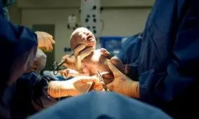 شبی ۷۰ میلیون تومان؛ نرخ های نجومی زایمان در بیمارستان‌های خصوصی