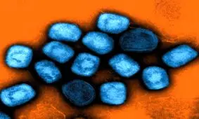 هشدار دانشمندان درباره شیوع انسانی آبله میمون