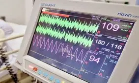 افزایش شیوع سکته‌ها در کشور/ ضرورت گسترش مراکز درمان سکته حاد مغزی