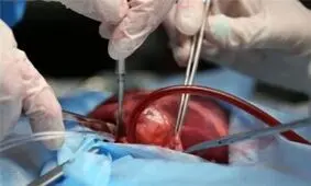 همدستی شوهر و پزشک برای فروش کلیه یک زن