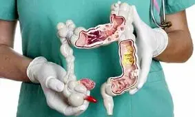 افزایش ابتلا به سرطان روده در جوانان