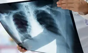 پیش بینی خطر مرگ با استفاده از هوش مصنوعی