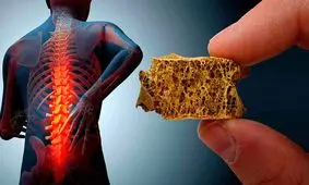 بیماری خاموشی که زنان را بیشتر از مردان تهدید می‌کند