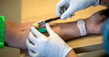 تشخیص همزمان چند نوع سرطان با یک آزمایش خون واقعا جواب می‌دهد؟