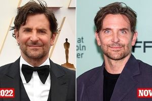 بردلی کوپر جراحی زیبایی کرد؟