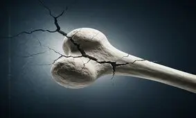 چرا با افزایش سن، سلامت استخوان ها تهدید می‌شود؟