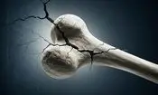 چرا با افزایش سن، سلامت استخوان ها تهدید می‌شود؟