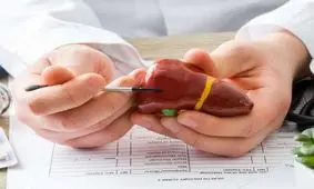 چرا به کبد چرب مبتلا می‌شویم؟