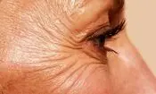 چگونه با افزایش سن از «پروتئین نگهدارنده بدن» مراقبت کنیم؟