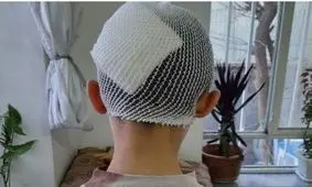 شکستن سر دانش آموز توسط معلم در آذربایجان غربی