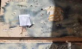 فروش کلیه با نرخ دولتی؛ ۸۰ میلیون تومان