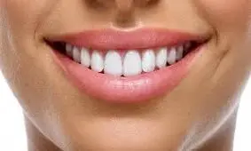 فرق لمینت و کامپوزیت دندان
