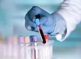 حذف یک آزمایش مهم از پوشش بیمه