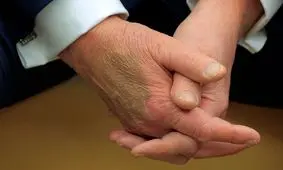 بحث سلامتی ترامپ دوباره بالا گرفت/ ترامپ دروغ می‌گوید؟