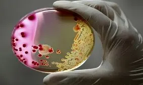 ناسا یک باکتری جهش‌یافته و خطرناک را در فضا کشف کرد

