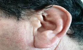 چند توصیه برای باز کردن گرفتگی گوش

