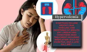اضافه بار مایعات یا هیپرولمی: چه چیزی باعث آن می شود و چگونه درمان می شود؟