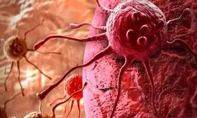 غربالگری کدام سرطان‌ها اولویت دارد؟